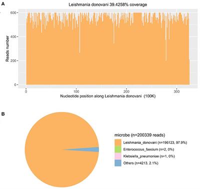 Leishmania donovani visceral leishmaniasis diagnosed by metagenomics next-generation sequencing in an infant with acute lymphoblastic leukemia: a case report